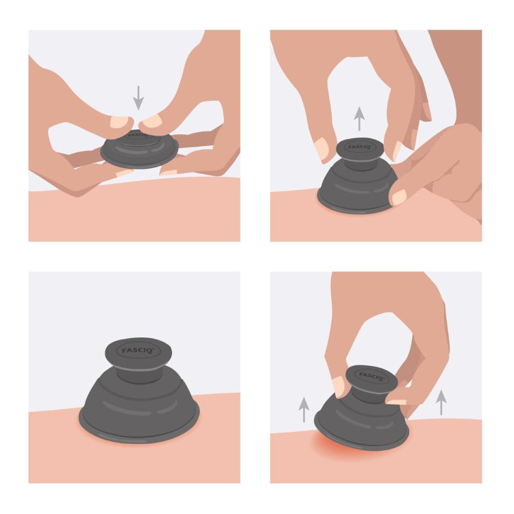 Fasciq Ultimate Cupping Collection 