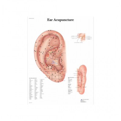 Χάρτες Ωτοβελονισμού