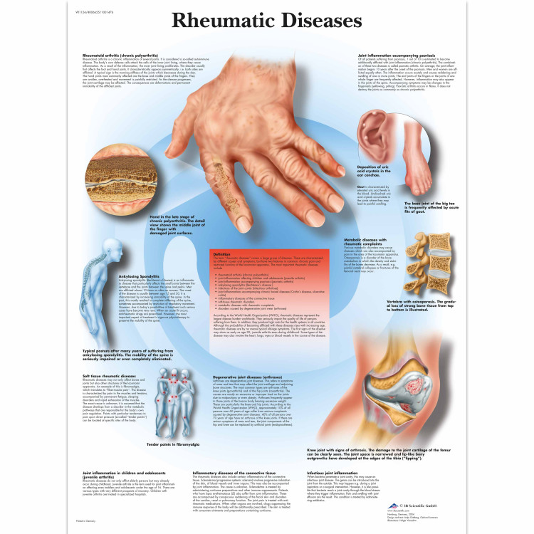 VR1124 Rheumatic Diseases Poster