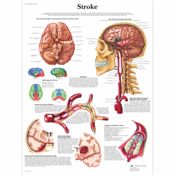 VR1627 Stroke Poster