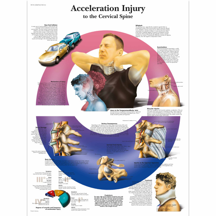 VR1761 Acceleration Injury To The Cervical Spine Poster