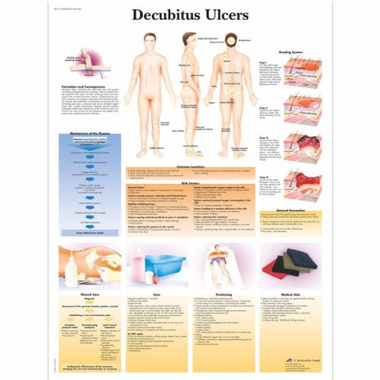 VR 1717 Poster Decubitus Ulcers 